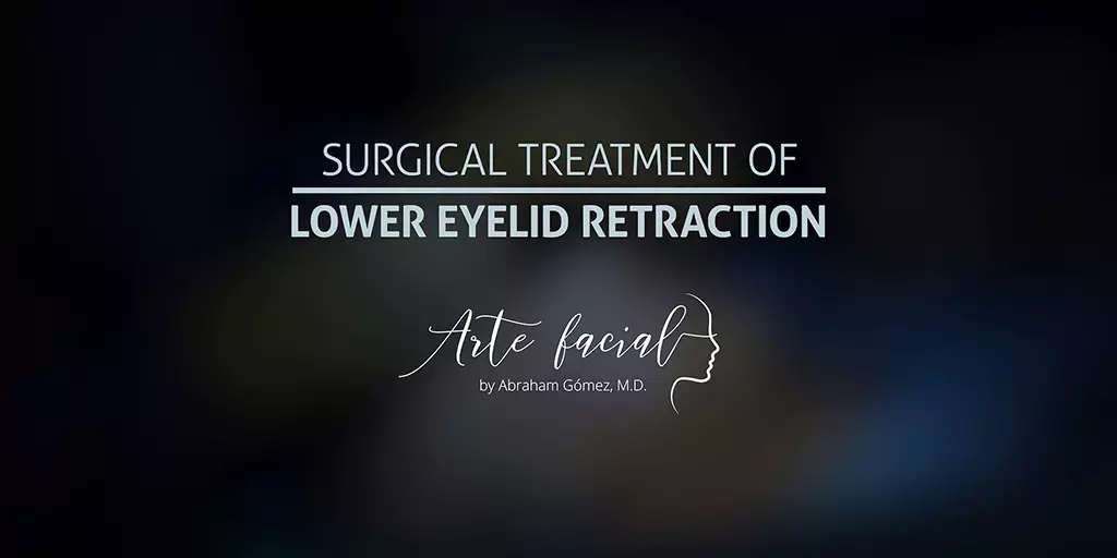 Eye and eyelid plastic surgery in Costa Rica - Arte Facial